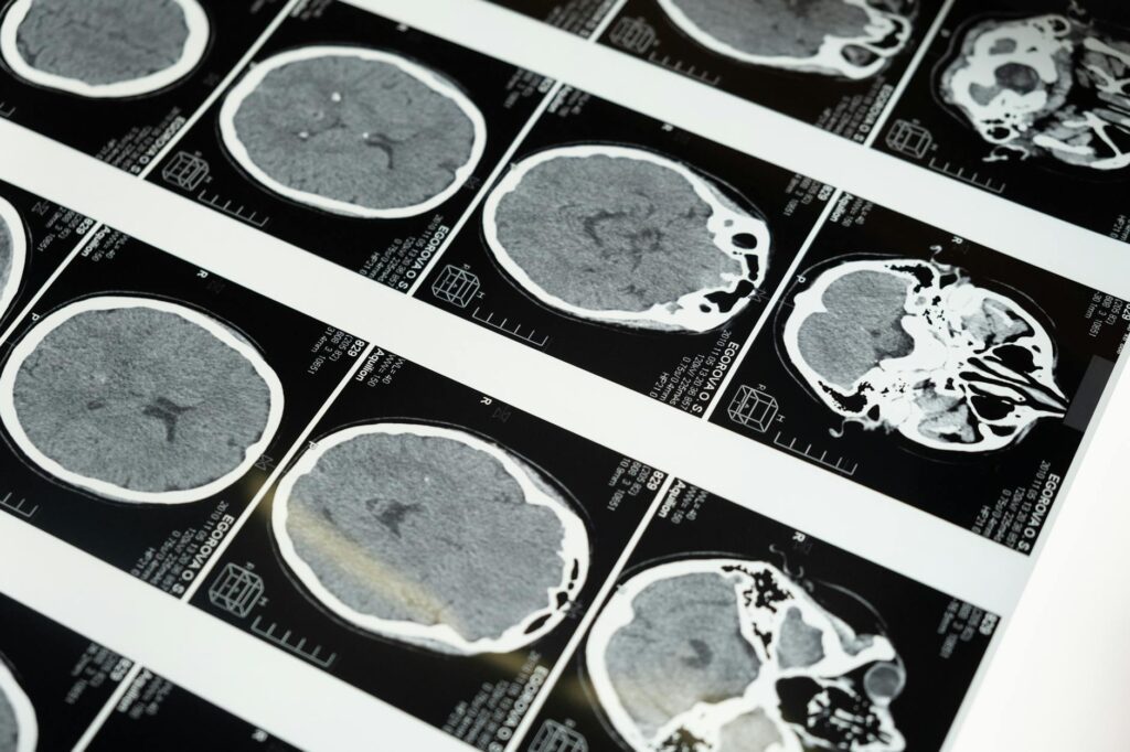 mri images of the brain